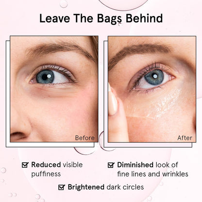 Under Eye Brightener Roller - Airplane Travel Essentials - Retinol & Caffeine Eye Serum for Puffiness, Dark Circles, Wrinkles - Vegan Skincare