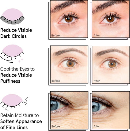 Award Winning Under Eye Mask Reduce Dark Circles, Puffy Eyes, Undereye Bags, Wrinkles, Gel Under Eye Patches, Birthday Gifts for Women - Vegan (24 Pairs, Blue)