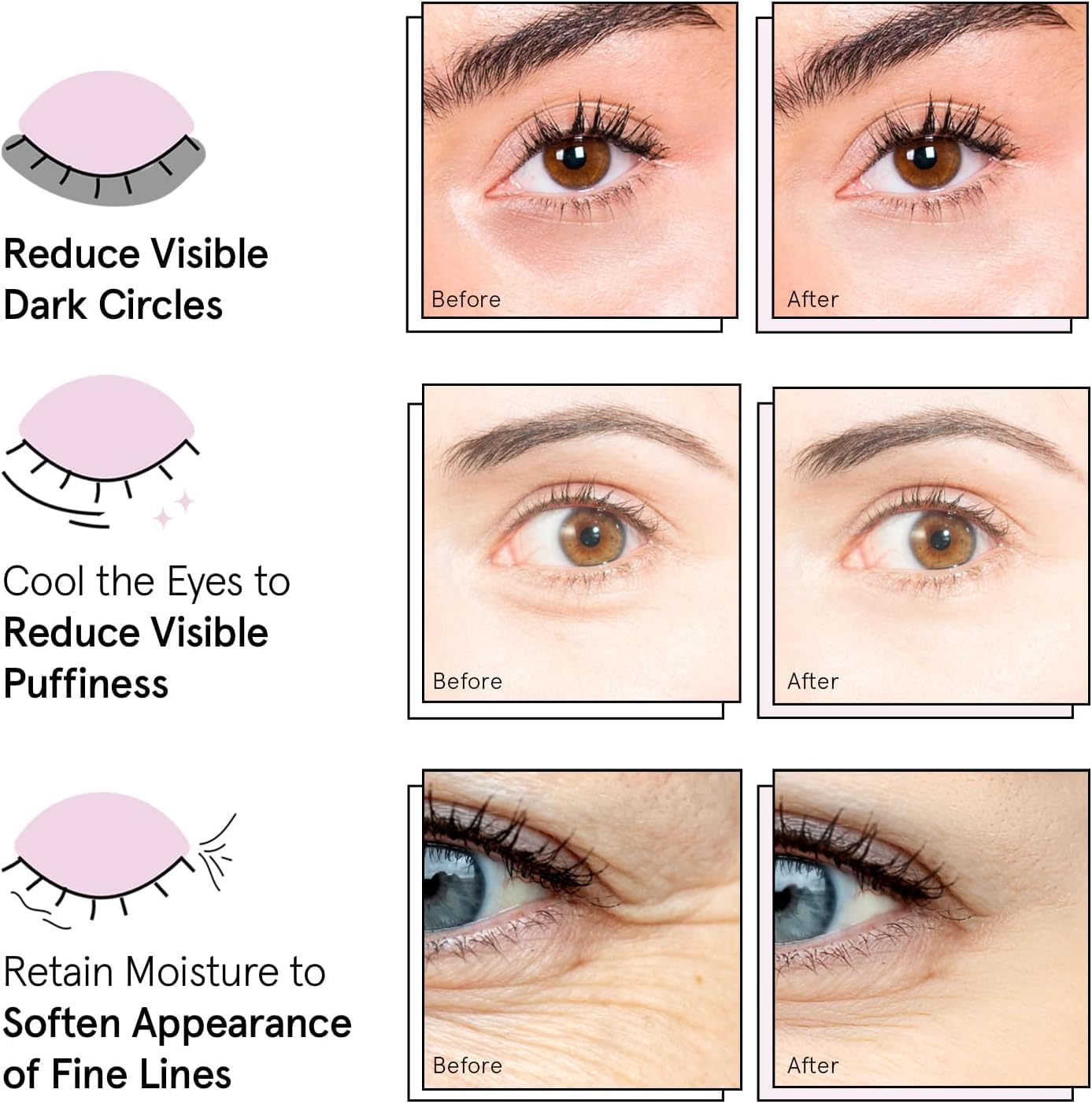 Award Winning Under Eye Mask Reduce Dark Circles, Puffy Eyes, Undereye Bags, Wrinkles, Gel Under Eye Patches, Birthday Gifts for Women - Vegan (24 Pairs, Blue)
