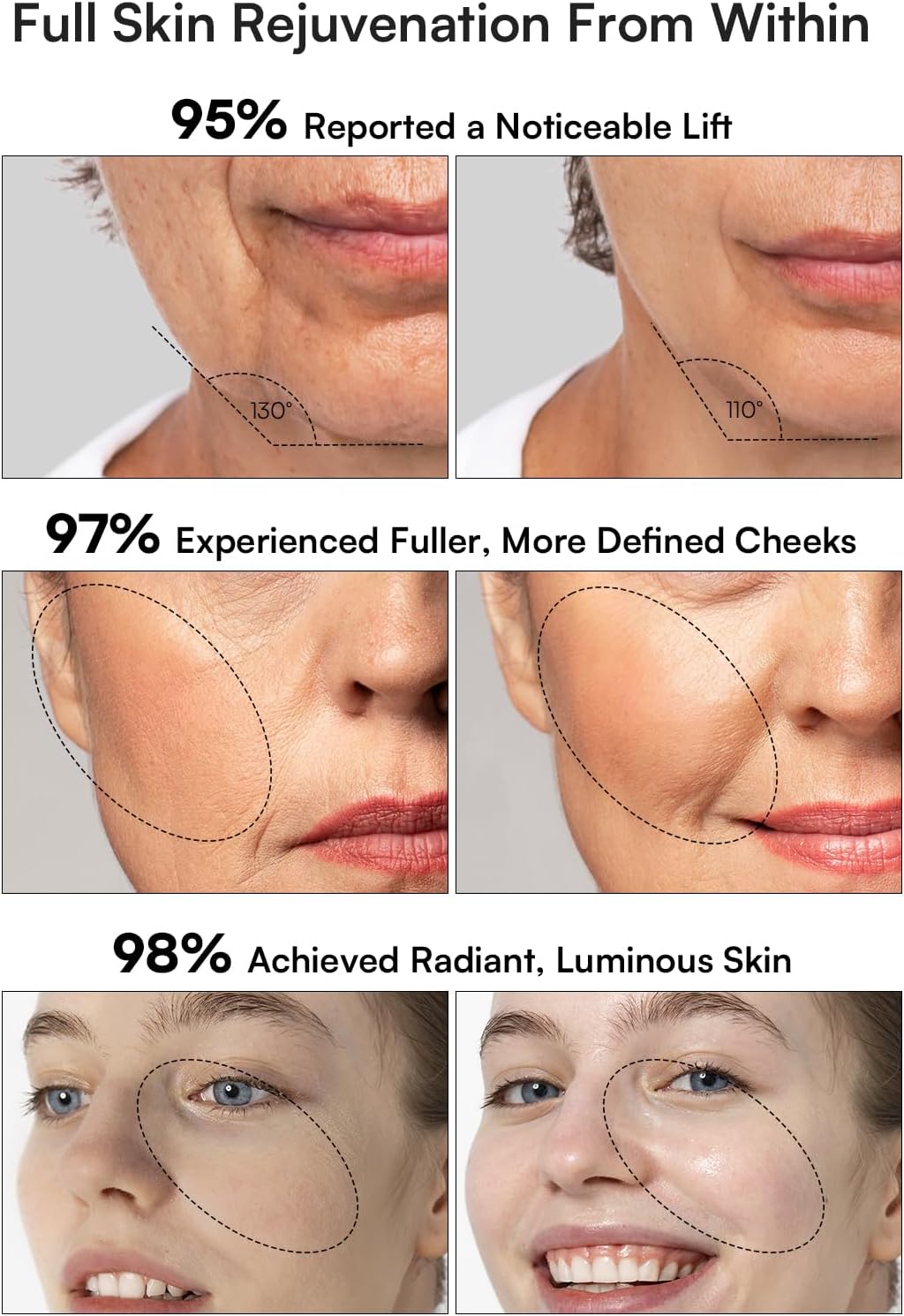 3-in-1 Skin Tightening Device True Beauty Glow Facial Massager