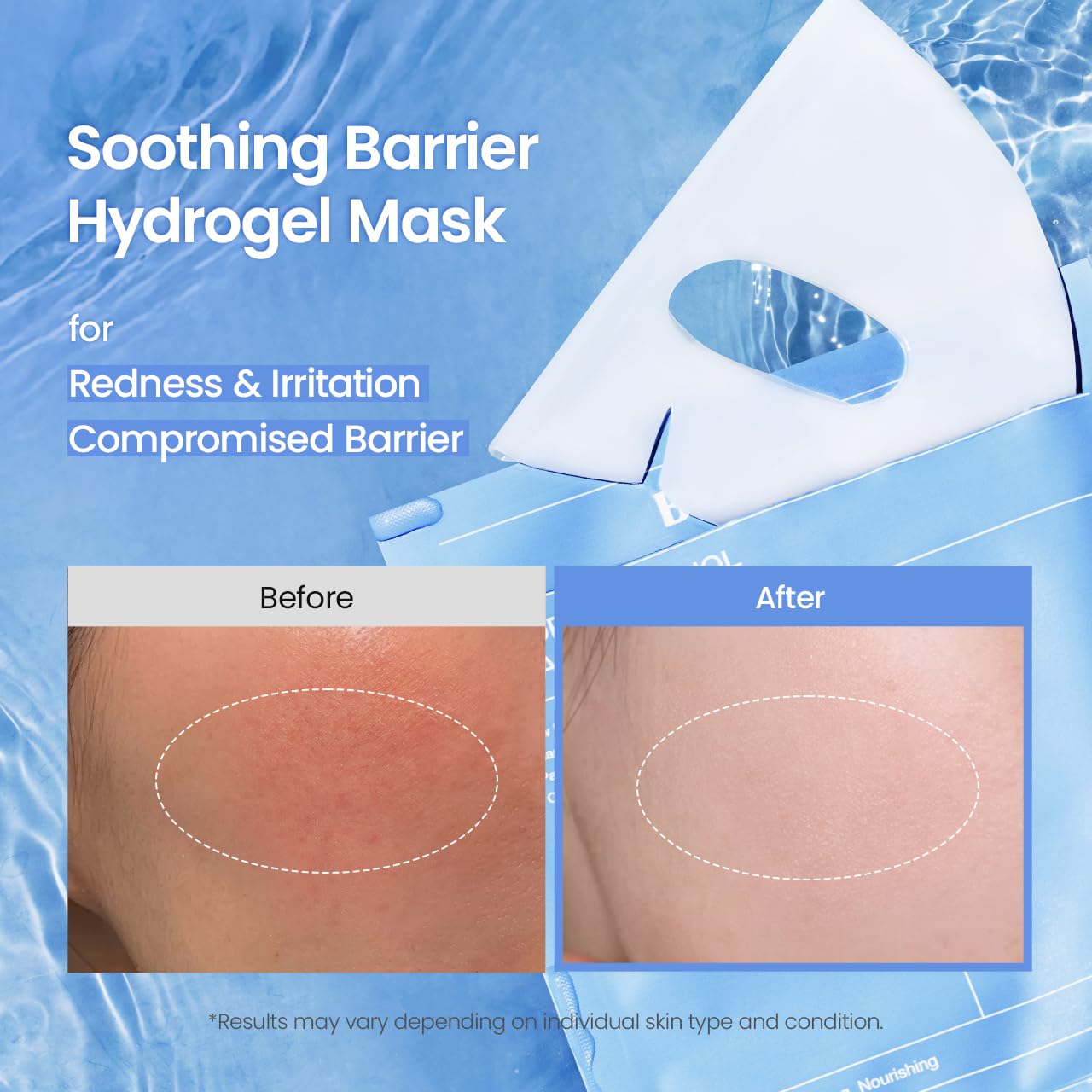 Bio-Collagen Real Deep Mask, Hydrating, Pore Minimizing, Elasticity, Plumping Improvement, Korean Skin Care